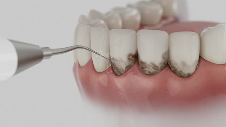 Trusted Wisdom Tooth Removal service in McRae-Helena, GA - Dentist Open Now